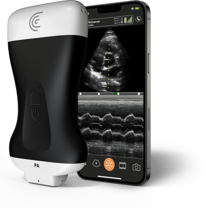 Product PA Phased Array Handheld Portable Wireless Ultrasound Scanner