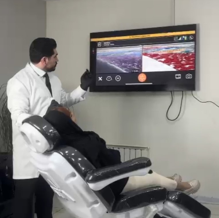 T.mode Clarius 2 t.mode clarius سونوگرافی لایه های صورت و زیبایی
